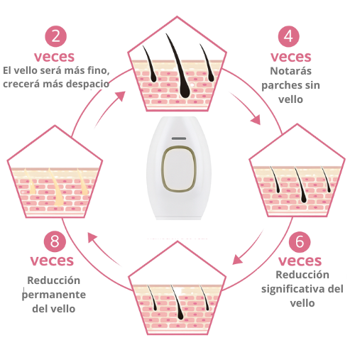 Depiladora IPL – Luz Pulsada de Alta Precisión